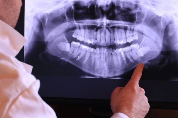 Best Emergency Treatment for Oral Infections in Nora Springs, IA